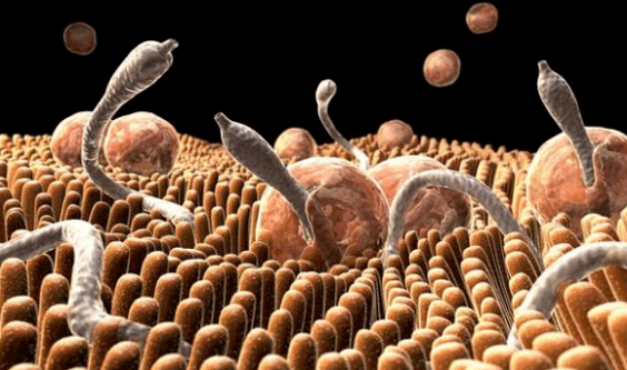 Parásitos en el cuerpo humano